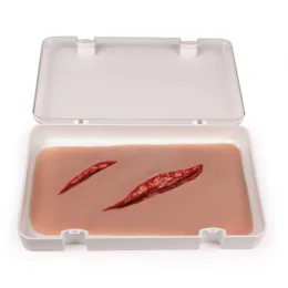 Wundmoulage mit Blutungsfunktion